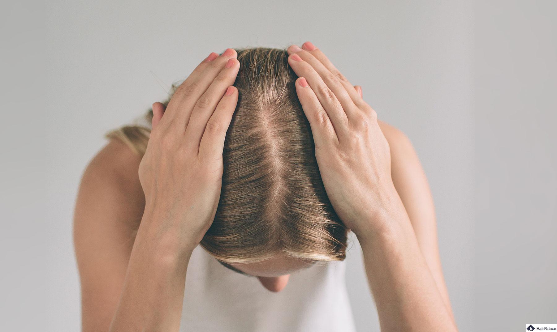 Affordable Hair Transplant UK Options You Can Trust